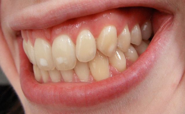 Capricho sexual de un hombre dejó sin dientes a una mujer