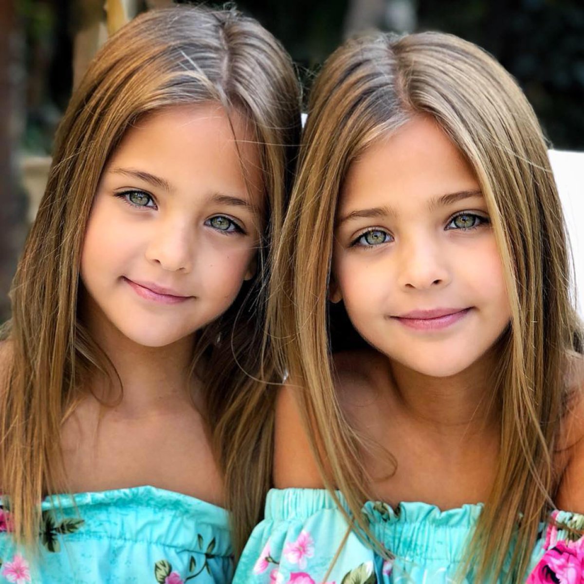Conoce a las gemelas más bellas del mundo que todos quieren conocer