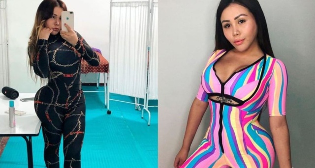 Esta fue la millonada que se gastó Yina Calderón en su operación