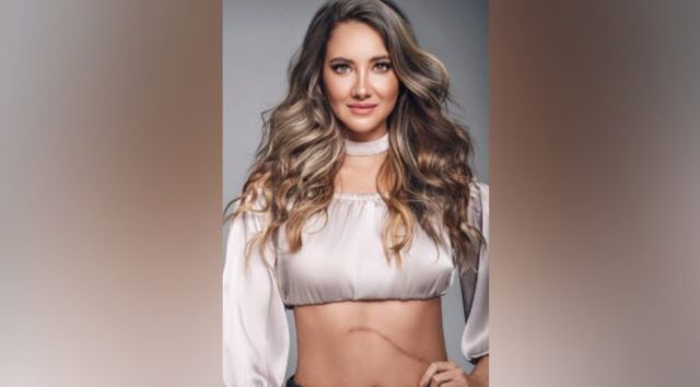 Daniella Álvarez reveló que tuvo coronavirus tras la amputación de parte de su pierna