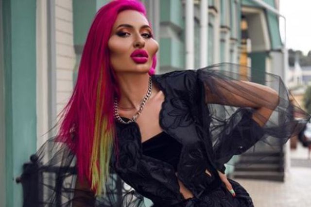 Mujer con los pómulos más grandes del mundo impactó en las redes sociales