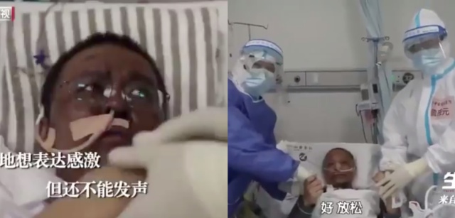Dos médicos chinos cambian de color tras tratamiento contra el covid-19
