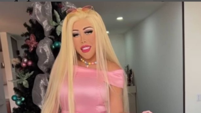 Yina Calderón pasó de nuevo por el quirófano para convertirse en una barbie humana