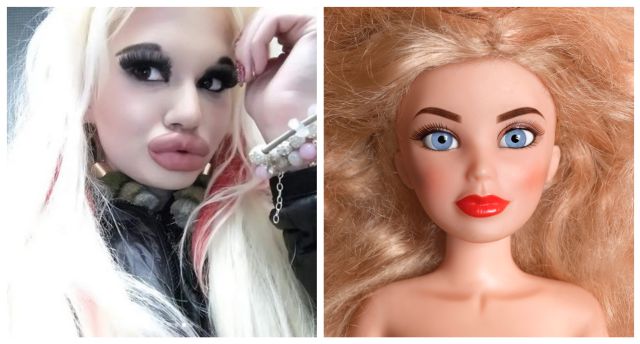 Esta es la mujer con los labios más grandes del mundo que sueña con ser la “Barbie humana”