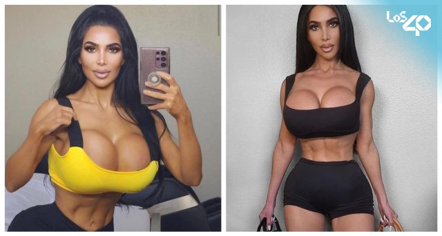 Murió “Kim Kardashian”, la doble de la modelo en TikTok, después de una fallida cirugía
